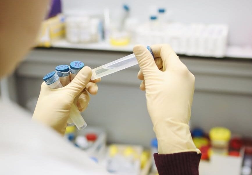 Sospetto Hantavirus: test su turista argentina in ospedale a Messina